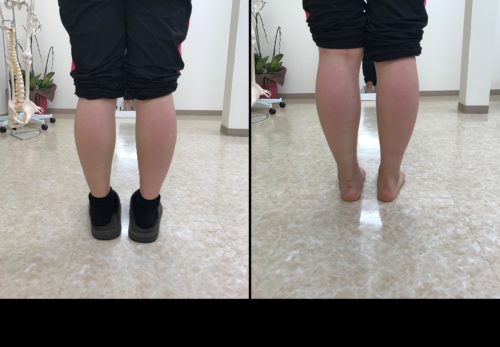 整体師が勧める魔法の靴下！足のむくみ疲れに本気で答えてくれます。それが磐田の整体院にあります