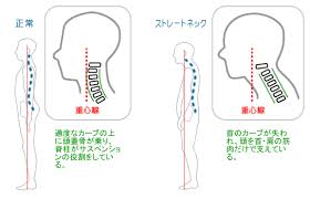 磐田　整体　首こり　ストレートネック