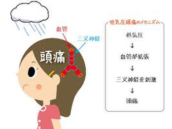 偏頭痛のお持ちの方必見！！　