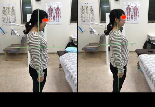 首や肩が凝りやすく、腕があげにくかったり、頭痛を起こしやすい…それは〇〇〇！
